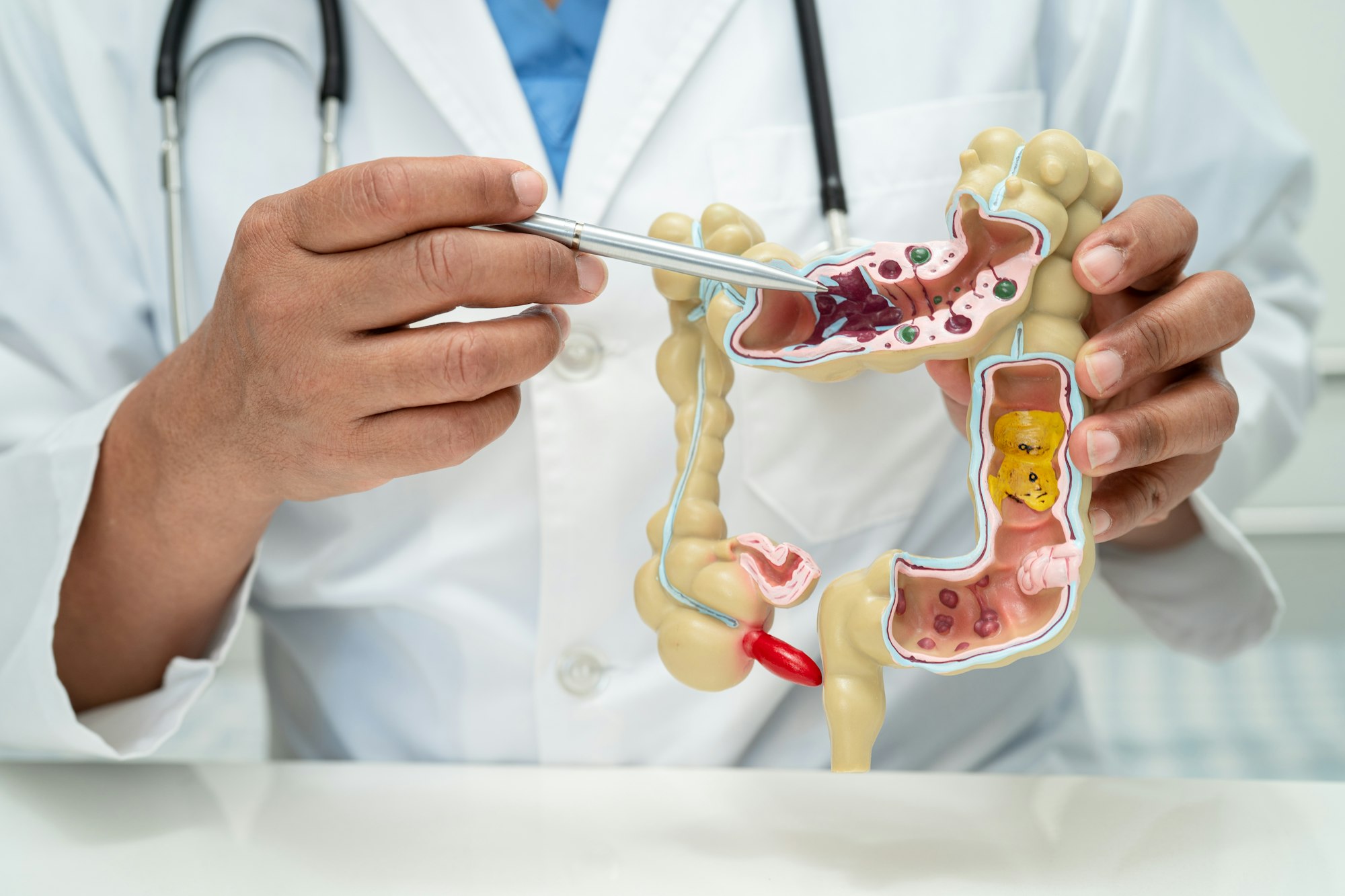 Intestine, appendix and digestive system, doctor holding anatomy model